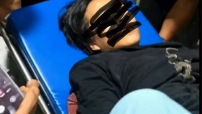 Kejar Pelaku Curanmor, Pemuda di Percut Sei Tuan Nyaris Tewas Dibacok Senjata Tajam